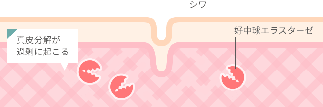 シワができる仕組み